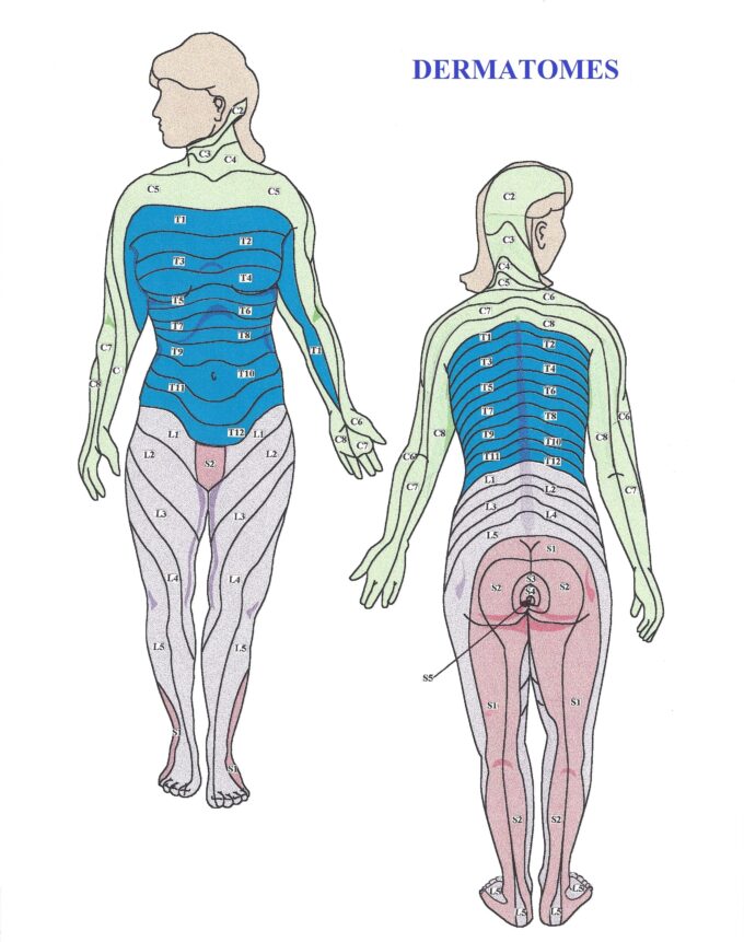 Fig. 1. Map of dermatomes