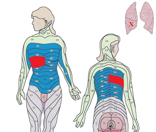Fig. 3. Middle lobe of the right lung