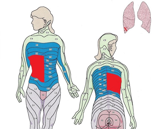 Fig. 3. Lower lobe of the right lung
